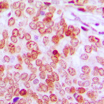 ATF5 Antibody