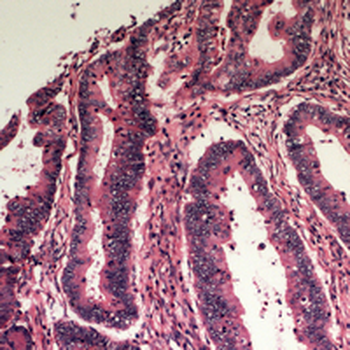 Apolipoprotein L3 Antibody