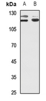 PPP1R13B Antibody
