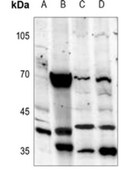 Melatonin Receptor 1a Antibody