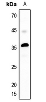 MASP1 LC Antibody