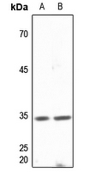 DNAJB2 Antibody