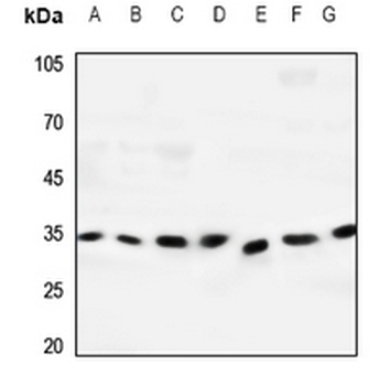 Dectin 2 Antibody