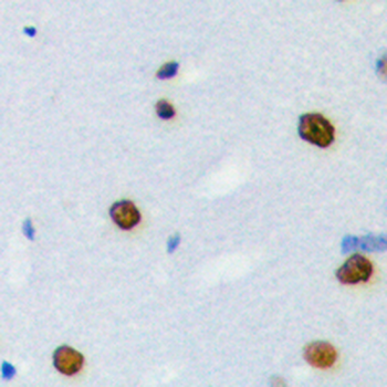 hnRNP LL Antibody