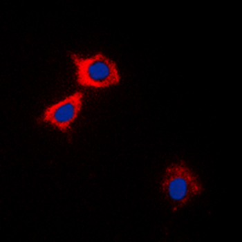 CaMK2 alpha/delta Antibody