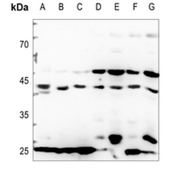 CDKL4 Antibody