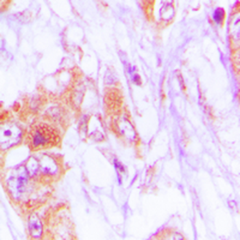 CDKL4 Antibody