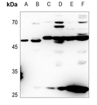 ACOT4 Antibody