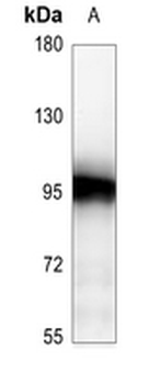 ATRIP Antibody