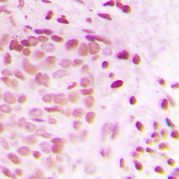 ATRIP Antibody