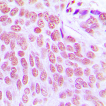 ITPKC Antibody