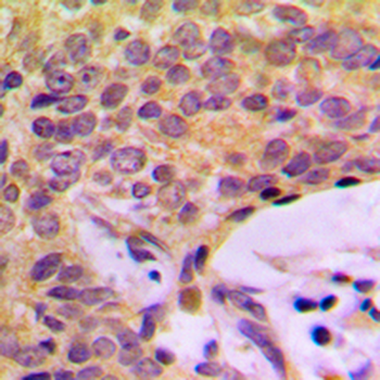 CCP2 Antibody