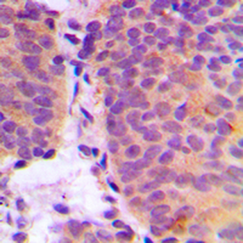 CHSY2 Antibody