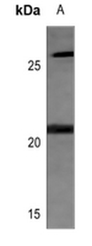 MRPL11 Antibody