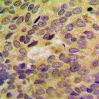 SH3GLB2 Antibody