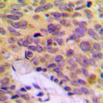 MRPL16 Antibody