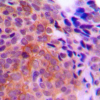 CK1 gamma 1 Antibody