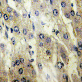 FATP5 Antibody