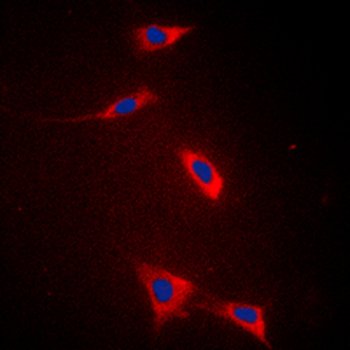 FATP5 Antibody