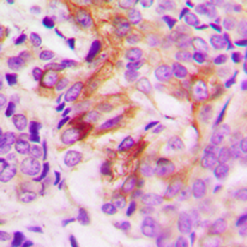 ANGPTL7 Antibody