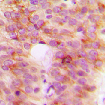 TANK Antibody