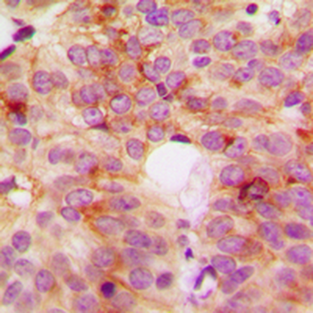 ACOT8 Antibody