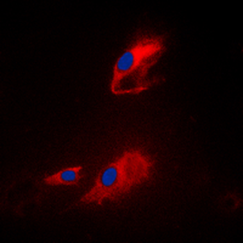 ACOT8 Antibody
