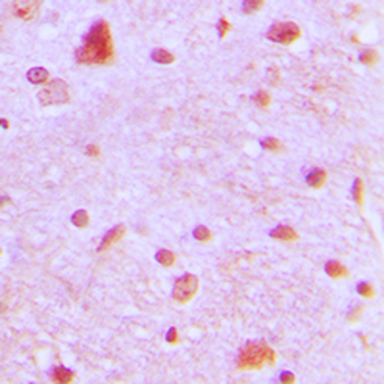 ARNT2 Antibody
