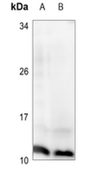 Histone H4 (pS47) Antibody