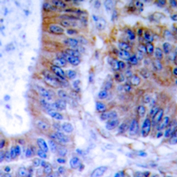 TNFAIP1 Antibody