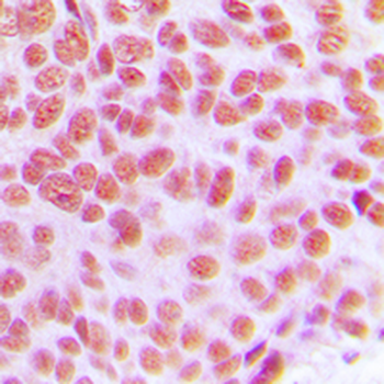 AP2 gamma Antibody