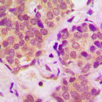 STAT6 (pY641) Antibody