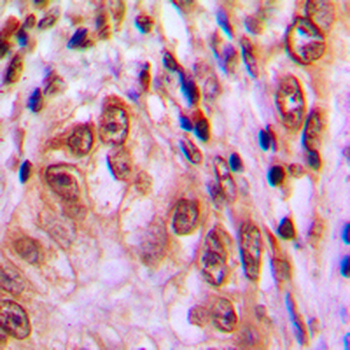 STAT4 (pY693) Antibody