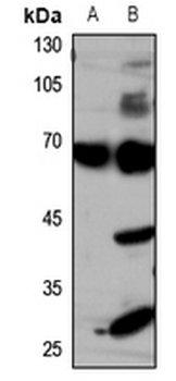 GLUT4 Antibody