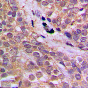 AMPK alpha 1 (pS496) Antibody