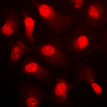 AMPK alpha 1 (pS496) Antibody