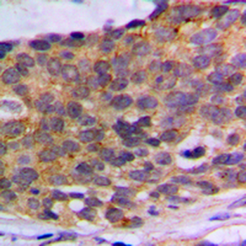 PLA2G4A Antibody