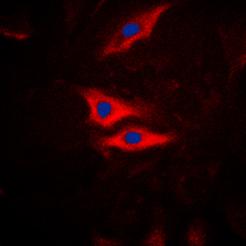 PLA2G4A (pS505) Antibody