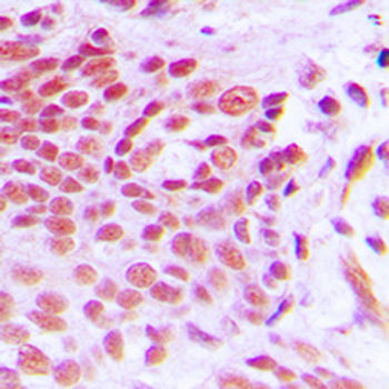 NAB2 Antibody