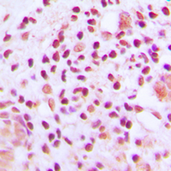 MUTYH Antibody