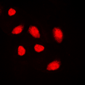 MUTYH Antibody