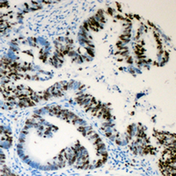 Lamin A/C (pS392) Antibody
