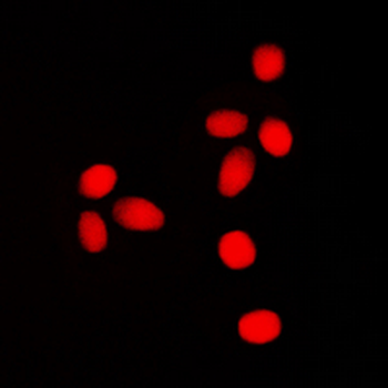 Lamin A/C (pS392) Antibody