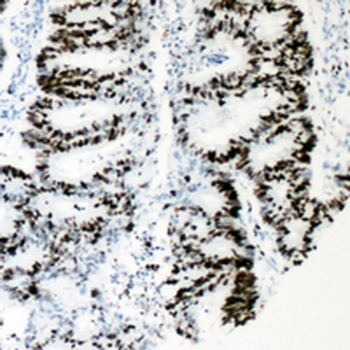 HNF4 alpha (pS313) Antibody