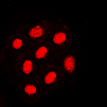 HNF4 alpha (pS313) Antibody