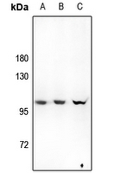 Hexokinase 3 Antibody