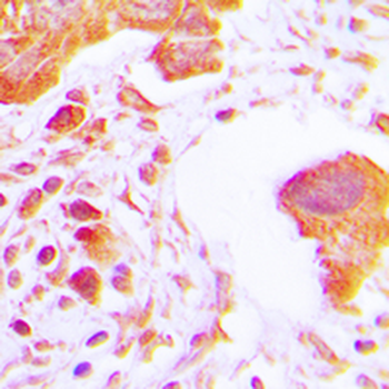 Hexokinase 3 Antibody