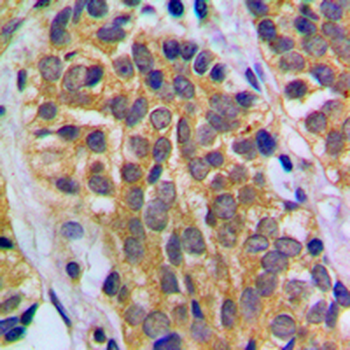 HEXB Antibody
