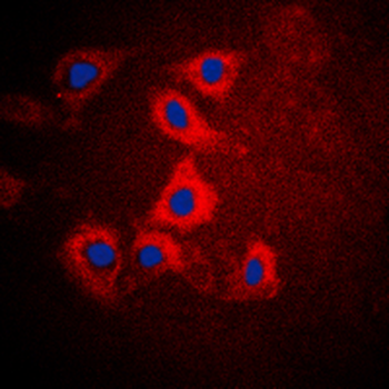 HEXB Antibody