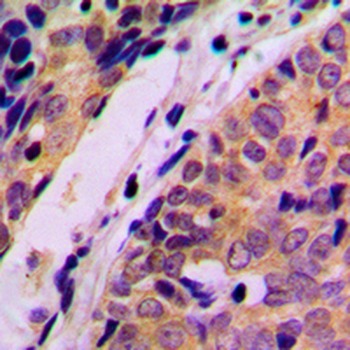 HARS Antibody